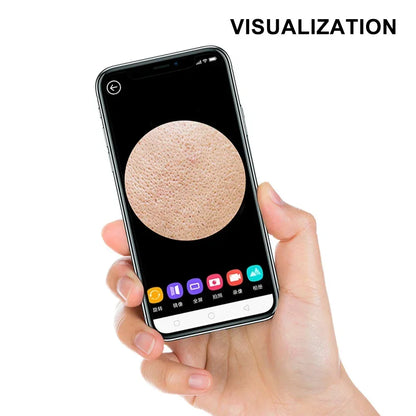 LumiSkin Blackhead Remover with HD Camera - LumiSkin